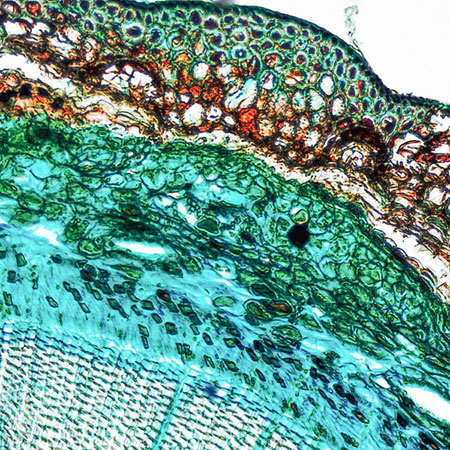 microscopic view of tree structure and cells